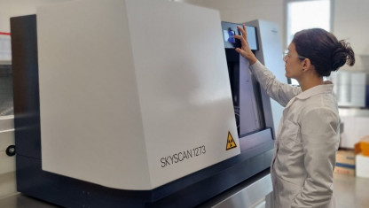 imagen Análisis cuantitativo de imágenes 3D para la estimación del sexo